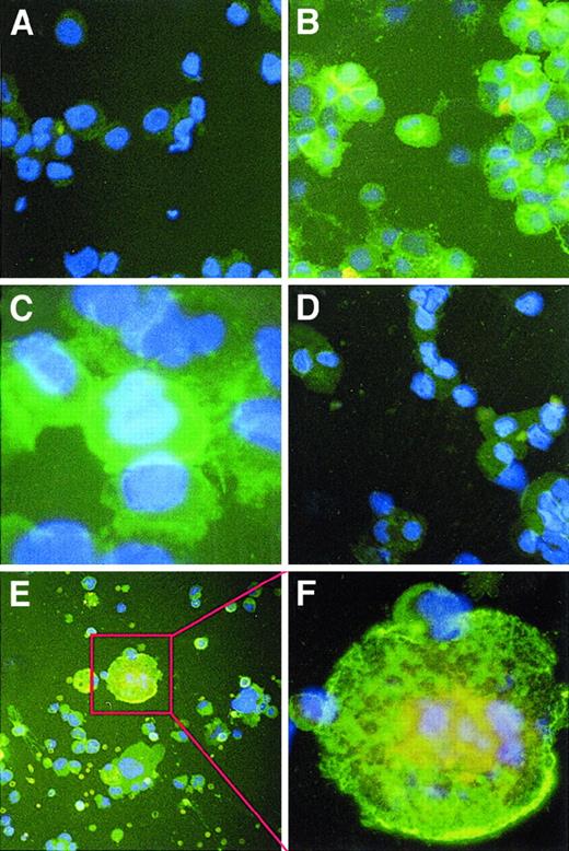 Fig. 3. Immunohistochemical staining of human and murine megakaryocytes for MMPs. / Cytospin preparations of ex vivo–expanded human and murine MKs were stained with MMP-2 and -9 mouse mAbs and goat-antimouse-FITC antibody, along with DAPI counterstain, and they were observed by fluorescence microscopy at a magnification of 400 × (A,B,D,E) and 1000 × (C,F). (A) An irrelevant IgG control showed little nonspecific staining. There was also low staining for MMP-2 (D). Staining of polyploid human (B,C) and murine (E,F) MKs revealed the presence of MMP-9 on the cell surface. Results are representative of 3 separate experiments.
