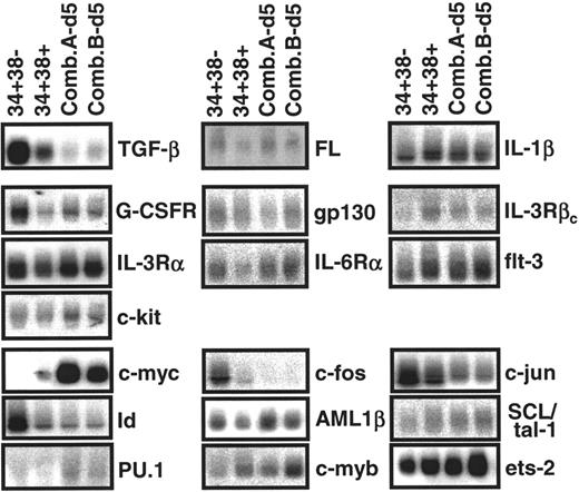 Fig. 1. Representative analysis of transcripts found in different populations of primitive adult BM cells. / RNA extracts from purified CD34+CD38−(34+38−) and CD34+CD38+ (34+38+) adult BM cells and their progeny obtained after 5 days of stimulation by 2 growth factor combinations (A and B, described in “Materials and methods”) were subjected to semiquantitative RT-PCR, followed by Southern blot analysis using gene-specific cDNA probes. Each filter was then stripped and reprobed with a GAPDH probe (not shown) to allow normalization for cDNA loading.