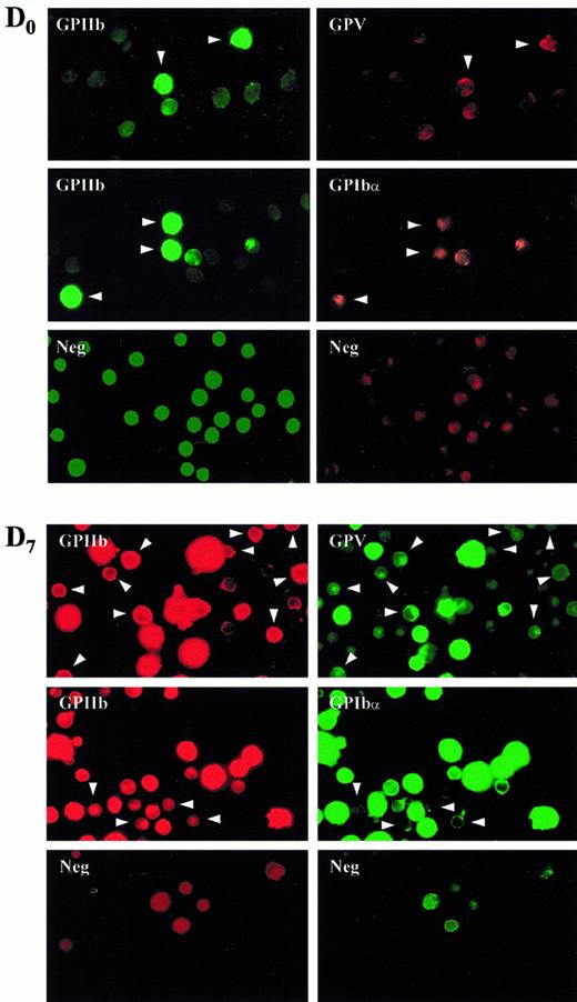 Fig. 7. Double-labeling fluorescence microscopy of GPIIb/GPV and GPIIb/GPIbα expression on permeabilized cultured CD34+cells. / CD34+ cells were permeabilized on the day of collection (day 0) and double labeled with anti-GPIIb revealed by FITC-GAM and anti-GPV–Cy3 or anti-GPIbα–Cy3. Cells at day 7 were permeabilized and labeled with anti-GPIIb revealed by GAM-Cy3 and anti-GPIbα–Alexa 488 or anti-GPV revealed by an Alexa 488–conjugated secondary antibody. The arrows indicate cells that are CD41+ but GPIbα− or GPV−. Neg represents the fluorescence of cells incubated with FITC-IgG1, Cy3-IgG1, or Alexa 488–IgG1.