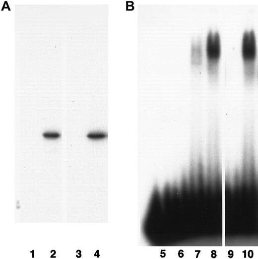 Fig. 3. Biochemical properties of cbfβ protein. / (A) The cbfβ associates with human CBFα2. 35S-labeled in vitro–translated human CBFβ (lanes 1 and 2) and zebrafish cbfβ (lanes 3 and 4) proteins were immunoprecipitated by an anti-CBFα2 antibody in the presence (lanes 2 and 4) or absence (lanes 1 and 3) of the CBFα2 protein and separated by electrophoresis. (B) The cbfβ enhances DNA binding by CBFα2. A 32P-labeled oligonucleotide (HA) containing the recognition site for CBF was incubated with the in vitro–translated proteins and separated by electrophoresis. H2O control, lane 5; in vitro translation lysate control, lane 6; human CBFα2 alone, lane 7; human CBFα2 plus CBFβ, lane 8; zebrafish cbfβ alone, lane 9; human CBFα2 plus zebrafish cbfβ, lane 10.