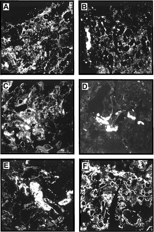 Fig. 5. Expression of laminin chains in human bone marrow. / The micrographs show immunofluorescence stainings of bone marrow cryostat sections stained with the following antilaminin antibodies: (A) antiserum against the α4 chain; the staining is mainly found in intersinusoidal spaces; (B) mAb 4C7 against the α5 chain; expression is restricted to the endothelial cells; (C) mAb against the β1 chain; (D) mAb C4 against the β2 chain; the staining is restricted to the larger blood vessels; (E) mAb D18 against the γ1 chain; and (F) an antiserum against the LN-1 isoform recognizing α1, β1, and γ1 chains. Comparable staining patterns in intersinusoidal spaces and in basement membranes of adipocytes and endothelial cells are apparent in panels C, E, and F, although at different intensities. (Original magnification × 110.)