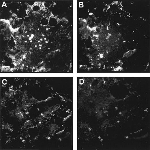 Fig. 6. Localization of laminin α4 chain in human bone marrow. / Double labeling of bone marrow cryostat sections with antilaminin α4 antiserum (A,C) and the endothelial cell–specific antibody Rb10 (B) or the mAb against α-SM actin (D), respectively, revealed that the laminin α4 chain is mainly found outside the endothelial cells. The colocalization of laminin α4 chain and α-SM muscle actin indicates an expression of laminin α4 in intersinusoidal stromal cells and myoid cells lining sinuses. (Original magnification × 220.)