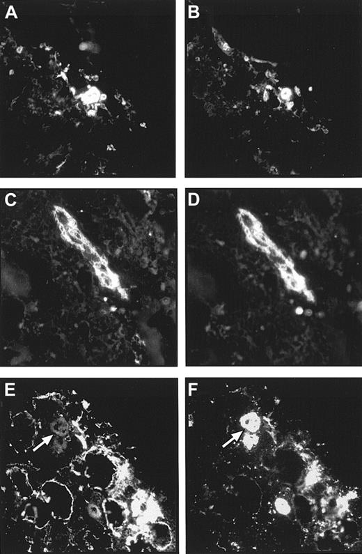 Fig. 7. Colocalization of laminin chains in arteriolar walls and in megakaryocytes. / (A,B) The 2 micrographs show 2 consecutive bone marrow cryostat sections stained with the antilaminin α5 chain antibody, 4C7 (A), and the antilaminin β2 chain antibody, C4 (B). A colocalization of these 2 laminin chains in arteriolar walls cells could be observed. (C,D) By double labeling of a bone marrow cryostat section, a coexpression of the laminin α2 chain (C) and of α-SM actin (D) could also be found in arteriolar walls of larger blood vessels within the marrow. Outside arteriolar walls no laminin α2 chain expression could be detected. (E,F) Double immunofluorescence staining of a bone marrow cryostat section with the polyclonal antiserum against the LN-1 isoform (E) and an anti–β3 integrin chain antibody (F) revealed that megakaryocytes (arrows in E and F) do not express laminin β1 or γ1 chains. (Original magnification × 220.)
