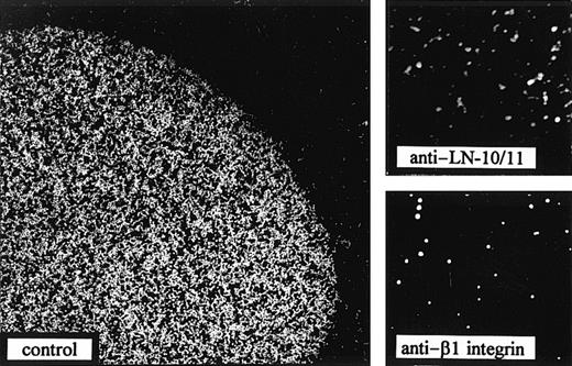 Fig. 10. Integrin-mediated adhesion to LN-10/11. / Cell adhesion assays of the myeloblastic cell line, KG1a, to LN-10/11 coated at a concentration of 5 μg/mL. In the control experiment, without any inhibitory factor, strong adhesion of the KG1a cells to LN-10/11 could be observed. Addition of an antiserum against LN-10/11 (diluted 1:100) completely abolished cell adhesion (anti–LN-10/11). Preincubation of KG1a cells with the β1 integrin antibody, 4B4 (diluted 1:50), for half an hour also inhibited cell binding to LN-10/11 (anti–β1 integrin). (Original magnification × 37.)