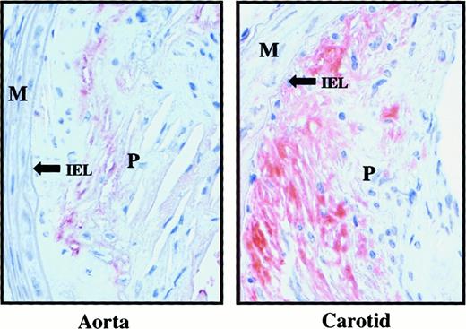 Fig. 2. Fibrin/fibrinogen staining of atherosclerotic lesions in 52-week-old apoE−/− mice. / Left panel shows ascending aorta; right panel shows distal common carotid artery. Fibrin/fibrinogen, identified by red staining, is more extensive at the carotid bifurcation than the aortic arch. M indicates media; IEL, internal elastic lamina; P, plaque.