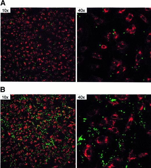 Fig. 2. Immunofluorescence microscopy of platelet adhesion. / Immunofluorescence microscopy shows adhering platelets (in green) on endothelial cells (in red). (A) Control shows platelet binding to unstimulated endothelial cells, with a few adhering platelets. (B) An increased number of adhering platelets on VEGF-stimulated endothelial cells is depicted compared to the unstimulated control in panel A. Magnification (40 ×) shows that most platelets adhere to the endothelial cells and to a lesser extent to the extracellular matrix.