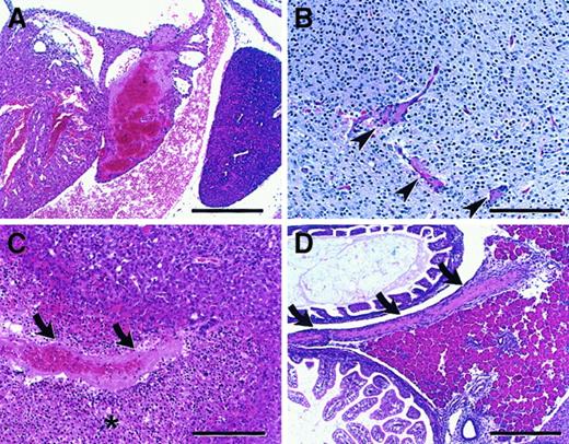 Fig. 4. Microscopic findings in neonatal homozygous FvQ/Q mice. / (A) Atrial thrombosis involving predominantly the left atrium with small right atrial thrombus attached to atrial septum (bar = 300μ). (B) Brain microthrombi (arrowheads), thalamic region (bar = 150μ). (C) Hepatic thrombus (arrows) with associated area of infarction (asterisk) (bar = 150μ). (D) Large thrombus (arrows) in mesentery adjacent to pancreas (bar = 300μ). All sections are stained with hematoxylin and eosin (H&E) (sections are from mice on a mixed 129Sv–C57BL/6J).