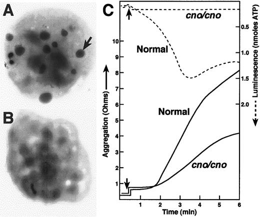 Fig. 2. Severe λ-SPD, resulting in prolonged bleeding, in cappuccino mice. / (A) (B) Electron micrographs of air-dried, unstained normal (panel A) and mutant (panel B) platelets. The arrow illustrates one of the many dense bodies visible in the normal platelet and lacking in thecno/cno platelet shown. Most cno/cno platelets have no visible dense bodies, but a small number have 1 or 2. (C) Platelet aggregation (solid lines) was determined in whole blood by the impedance method in response to collagen (4 μg/mL). Note the reduction of cno/cno platelet aggregation. Thecno/cno platelet-aggregation response to low collagen (1 μg/mL) was likewise reduced (not shown). Release of ATP, determined simultaneously by luminescence (dashed lines), is undetectable incno/cno. Arrows indicate the time of collagen addition.