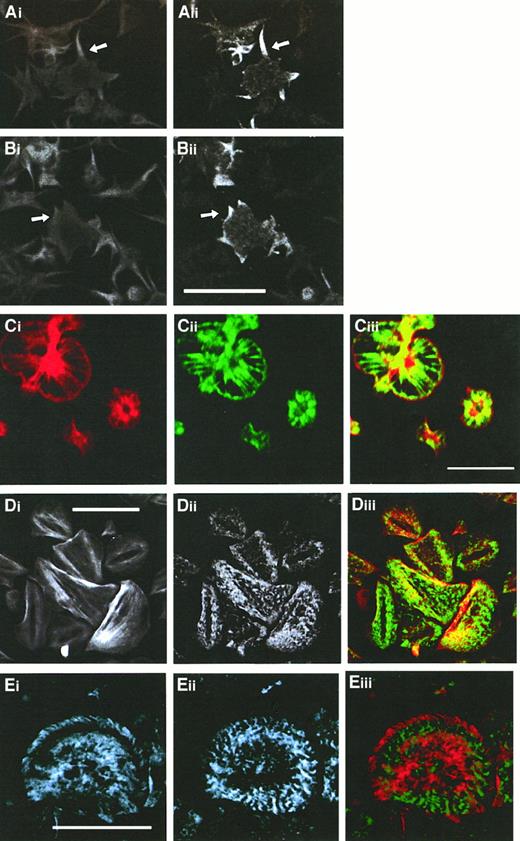 Fig. 3. Comparison of the subcellular localization of CLP36 and F-actin during various phases of platelet spreading. / Colocalization of F-actin (Ai,Bi, Ci,Di) and CLP36 (Aii-Dii) in early stages (Ai-Bii), and subsequent stages (Ci-ii) of platelet spreading, and after completion of spreading (Di-ii) was revealed by double immunofluorescence staining (merge Ciii,Diii). CLP36 staining of filopods (arrow in Aii) and lamellipods (arrow in Bii) formed during the early phase of spreading is homogenous and accumulates in patches (Cii) or dotted pattern (Dii,Eii) on F-actin–based structures in the late stages of platelet spreading. Note that CLP36 locates to the inner side of the cortical actin-filament belt during the spreading process (Ciii). Double immunofluorescent staining of the focal contact protein vinculin (Ei) and CLP36 (Eii), merge (Eiii); vinculin accumulates in the late stage of spread platelets in patches along circles or spirals at the microfilament tips.40 Bar, 10 μm.