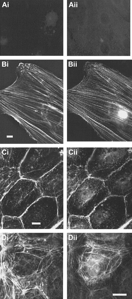 Fig. 4. CLP36 associates with actin stress fibers in endothelial cells. / Double immunofluorescence staining of CLP36 (Bii,Cii,Dii) and F-actin (Bi,Ci,Di). Controls (Ai-ii) for the specific staining of CLP36 were incubated with preimmune serum IgG (Ai) or with His-CLP36 for 1 hour before addition of anti-CLP36 antibody (Aii). Shown are subconfluent migrating endothelial cells (Ai-Bii), resting confluent endothelial cells (Ci-ii), and confluent endothelial cells exposed to thrombin (1 U/mL) for 2 minutes (Di-ii).