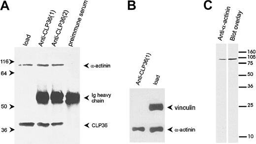 Fig. 7. CLP36 associates in vivo with α-actinin in platelets. / (A) Coimmunoprecipitation of α-actinin in anti-CLP36 immunoprecipitates. Anti-CLP36 antibodies from 2 different rabbits (designated 1 and 2) were used. (B) No coimmunoprecipitation of CLP36 with the focal contact protein vinculin. The anti-CLP36 immunoprecipitates were resolved by SDS-PAGE, blotted, and probed with anti-CLP36, anti–α-actinin, or antivinculin antibody. Load indicates platelet lysate before immunoprecipitation corresponding to 7% of lysate used for immunoprecipitation. The experiment is representative for 10 independent experiments. (C) Interaction between CLP36 and platelet α-actinin as detected by the blot overlay assay. Platelet proteins were blotted, and the blot was probed with anti–α-actinin antibody (left) or with biotinylated-CLP36 (right).