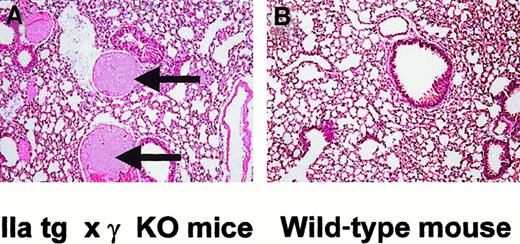 Fig. 4. FcγRIIA tg × γ-KO mice show abnormal lung pathology when compared with wild-type controls. / Lung sections (H&E, 100 ×) of FcγRIIA tg × γ-KO mice show intravascular fibrin precipitation and thrombus formation on the arterial side of the pulmonary circulation (A, arrows), whereas wild-type mouse lung sections show no thrombus formation (B).