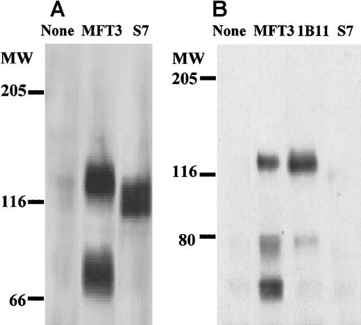 Fig. 2. Biochemical characterization of MFT3 antigen as the 130-kd CD43 glycoform. / (A) Lysates of bone marrow cells from BALB/c mice were subjected to sodium dodecyl sulfate–polyacrylamide gel electrophoresis (SDS-PAGE; 6% polyacrylamide gels), and Western blotting was performed with MFT3 or S7 (anti-115-kd CD43 glycoform) mAb. (B) MFT3-positive T-cell clones (KGU139) were lysed and immunoprecipitated with MFT3 mAb, subjected to SDS-PAGE (6%), and transferred to a nitrocellulose membrane. The membrane was probed with MFT3, 1B11 (anti-130-kd CD43 glycoform), or S7 mAb.