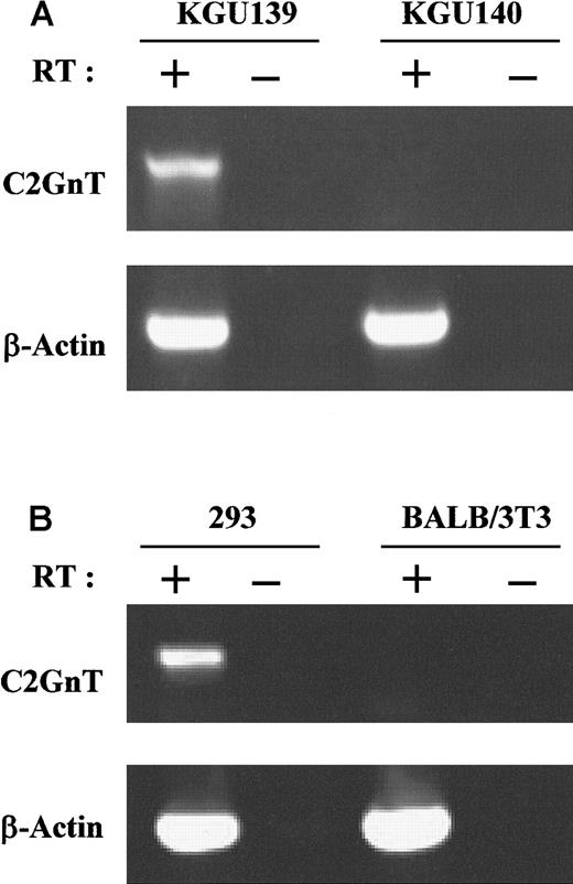 Fig. 4. C2GnT transcripts were detected in MFT3-positive but not MFT3-negative cells on analysis with RT-PCR. / (A) Total RNA from MFT3 antigen–positive (KGU139) and MFT3 antigen–negative (KGU140) T-cell clones was subjected to RT and amplified by PCR using C2GnT-specific primers or β-actin primers. (B) Total RNA from 293 cells and BALB/3T3 cells that were used as host cells in transfection experiments was subjected to RT-PCR analysis using the primers as in Figure 4A. PCR products were electrophoresed in agarose gels and stained with ethidium bromide. RT (+) indicates RNA reverse transcribed; and RT (−), RNA not reverse transcribed.