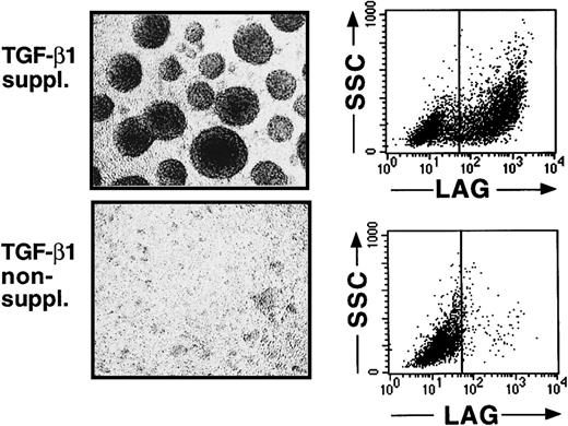 Fig. 2. Cells generated in the presence of TGF-β1 form large cell clusters and express the Birbeck granule antigen Lag. / Purified CD34+ cells were cultured for 12 to 14 days in serum-free medium supplemented with the cytokines GM-CSF plus TNFα, SCF, and FL in the presence or absence of TGF-β1. Day 12–generated cells were harvested and analyzed by phase-contrast microscopy (original magnification, ×20) and flow cytometry. Diagrams show expression of the intracellular Birbeck granule–associated molecule Lag versus orthogonal light scatter (SSC) of cells generated in the presence or absence of TGF-β1, as indicated. Markers were set according to negative control staining.
