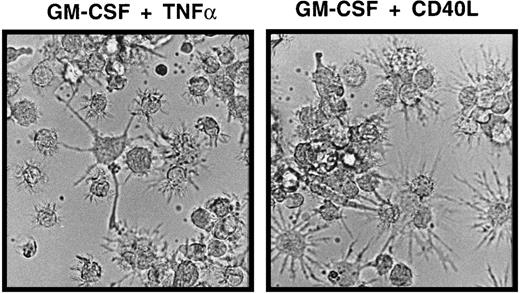 Fig. 4. Morphologic features of mature DCs in serum-free 2° cultures. / Cells were generated in serum-free medium in the presence of TGF-β1, as shown in Figure 1. They were resuspended and plated in serum-free 2° cultures (see “Materials and methods”) supplemented with GM-CSF plus TNFα or GM-CSF plus CD40L and cultured for 48 hours. The typical microscopic appearance of cells from these 2° cultures in the presence of GM-CSF plus TNFα or GM-CSF plus CD40L is shown (original magnification, ×40).