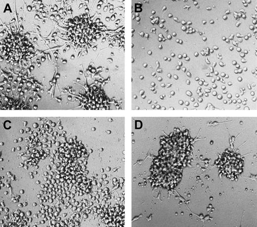 Fig. 6. Representative cell morphology in the presence of mAbs to adhesion molecules. / Generated cells from primary LC generation cultures were harvested and replated at a high cell density in 2° cultures supplemented with the cytokines GM-CSF plus TNFα, SCF, FL, and TGF-β1 in the presence or absence of mAbs specific for adhesion molecules. Photomicrographs show representative cell morphology (original magnification, ×20) of these 2° cultures before (B) or after (A, C, D) culture for 24 hours. Monoclonal antibodies of the following specificities were added: A, control; C, E-cadherin; D, CD43 (see also “Materials and methods”).