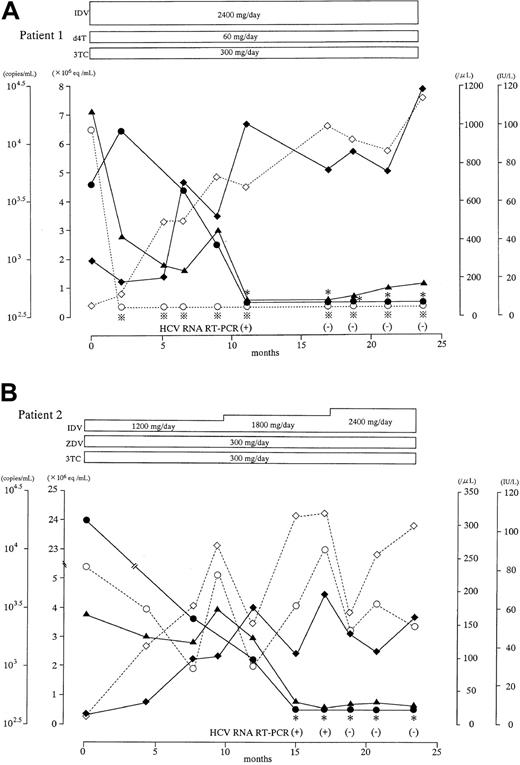 Fig. 4. Laboratory course of 2 patients coinfected with HCV and HIV whose HCV viremia was resolved after immune improvement with HAART. / Serum viral RNA levels and various immunologic values were measured as described in Figure 1. ∗ and indicate that the viral RNA level was below the respective detection limit (0.5 × 106 Eq/mL for HCV; 400 copies/mL for HIV). When the HCV RNA level was below the limit, nested RT-PCR was performed. Serial changes in serum HCV and HIV RNA levels (● and ○, respectively), peripheral B-cell and CD4+-cell counts (▪ and ■, respectively), and serum ALT concentrations (▴) are indicated. Antiretroviral drugs are abbreviated as follows: IDV, indinavir; d4T, stavudine; 3TC, lamivudine; ZDV, zidovudine.