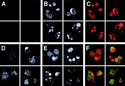Fig. 2. PTX3 recognizes membrane domains of cells undergoing apoptosis. / Jurkat cells, either alive (upper left quadrant of each panel) or committed to apoptosis by CD95 cross-linking (see “Materials and methods”) were fixed, permeabilized with saponin, and stained with biotinylated PTX3 (50 μg/mL) (panels D and F). Bound molecules were revealed by addition of FITC-streptavidin (panel D and green color in panel F). The fluorescence background obtained in the presence of streptavidin only is shown in panel A and as green color in panel C. Characteristics of the nuclei were revealed by addition of PI (panels B and E and red color in panels C and F).