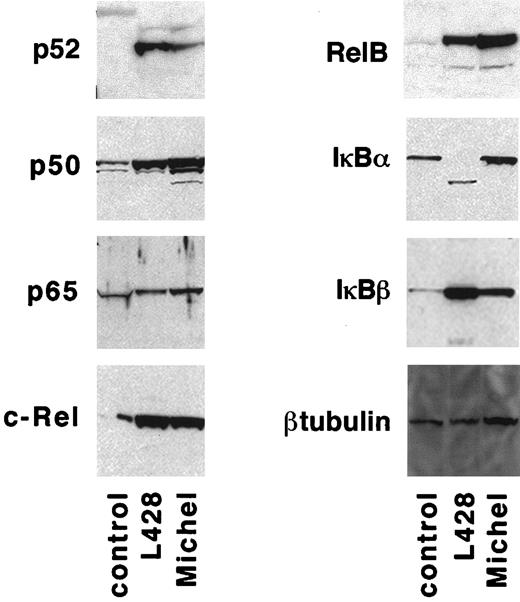 Fig. 3. HD cells have a specific defect in IκBα. / Protein lysates were prepared from 1 × 107 control cells (293 cells), L428 cells, and Michel cells and examined for IκB and NF-κB species by immunoblot analysis as described in “Materials and methods.”