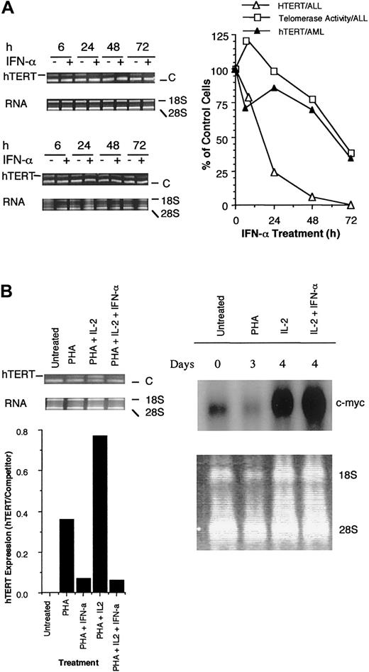 Fig. 3. Effects of IFN on telomerase in primary leukemic blasts and telomerase and c-myc in normal T-lymphocytes. / (A)Effects of IFN-α on hTERT levels and telomerase activity in leukemic blast from patients with ALL (left, upper panel) and AML (left, lower panel). Leukemic blasts were separated using lymphoprep separation, cultured in the presence or absence of IFN-α (5000 U/mL) for the indicated times, where after hTERT levels and telomerase activity were determined. (B) Influence of IFN-α on hTERT levels and telomerase activity and c-myc expression in T-lymphocytes during stimulation with PHA and IL-2. c-myc expression was analyzed by Northern blotting in quiescent (day 0), PHA (day 3), PHA/IFN-α (day 3), IL-2 (24 hours), and IL-2/IFN-α (24 hours)–treated cells. 18S and 28S rRNA serves as a control for equal loading. Data shown are representative of 3 independent experiments. C denotes the competitor band.