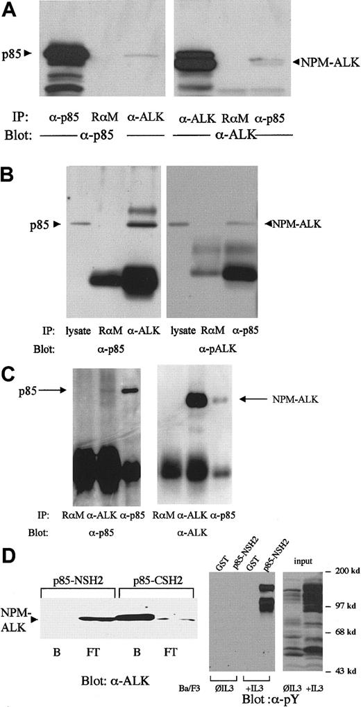 Fig. 1. NPM-ALK and p85 form a complex in vivo via the C-terminal SH2 domain of p85. / The 2 × 107 Ba/F3 cells stably transfected with NPM-ALK (A) or 2 × 107 Karpas299 cells (B) or 2 × 107SUP-M2 cells (C) were subjected to immunoprecipitations and immunoblotting with the antibodies indicated. Association of NPM-ALK with p85 is demonstrated by coprecipitation of p85 with an NPM-ALK antibody (A and B, left panel, right lane; C, left panel, middle lane) and by coprecipitation of NPM-ALK with anti-p85 antibody (A, B, C, right panel, right lane). A rabbit antimouse antibody (RαM) served as a negative control for the immunoprecipitation. (D) Left panel: 1 × 107 Karpas299 cells were lysed, then incubated with the C- or N-terminal SH2 domain GST-fusion proteins for 1 hour at 4°C. The bound (B) and the flow-through (FT) fractions were collected with glutathione-Sepharose, subjected to 7.5% SDS-PAGE, and analyzed by anti-ALK immunoblotting. Right panel: Lysates of 1 × 107 Ba/F3 cells cultured with and without IL-3 for 2 hours as indicated were incubated with the N-terminal p85 SH2 domain or GST as control for 1 hour at 4°C and the bound fractions were collected with glutathione-Sepharose. Input and bound fractions were subjected to 7.5% SDS-PAGE, and analyzed by antiphosphotyrosine immunoblotting.
