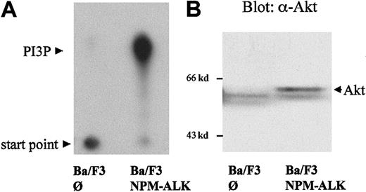 Fig. 2. Activation of PI 3-kinase and Akt by NPM-ALK. / The 5 × 106 Ba/F3 cells, stably transfected with empty vector (∅) or NPM-ALK, were starved for 4 hours in medium containing 0.5% FCS without IL-3. (A) PI 3-kinase activity was measured by incubation of antiphosphotyrosine (4G10) immunoprecipitates with phosphatidylinositol and P32-γg-ATP. P32-labeled–enzymatic products of PI 3-kinase were resolved by thin-layer chromatography (TLC) using a silica gel plate as described in “Materials and methods,” and visualized by autoradiography. (B) Cell lysates were subjected to 7.5% SDS-PAGE and immunoblotted using a goat polyclonal anti-Akt antibody. Mobility shift of Akt indicates its activation.