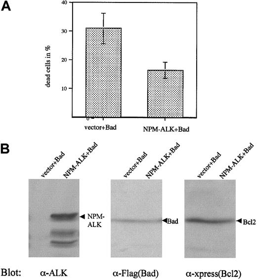 Fig. 7. NPM-ALK partially rescues Cos1 cells from Bad-induced apoptosis. / Cos1 cells were transfected with Xpress-tagged Bcl2 (xp-Bcl2) and Flag-tagged Bad (Flag-Bad), plus either empty vector or NPM-ALK. Three days after the transfection, both floating and attached cells were collected and living cells determined by trypan blue staining (A). Data represent values ± SD of at least 3 independent experiments. Expression of NPM-ALK (left panel), Bad (middle panel), and cotransfected Bcl2 (right panel) was demonstrated by immunoblotting (B).