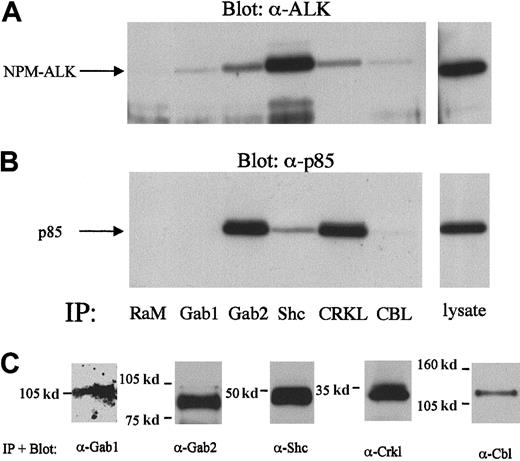 Fig. 10. Complex formation of Gab2, Shc, and Crkl with NPM-ALK and p85 in Karpas299 cell lysates. / The 2 × 107 Karpas299 cells were subjected to immunoprecipitations with the anti-Gab1,-Gab2,-Shc,-Crkl, or –Cbl antibodies and subjected to anti-NPM-ALK or anti-p85 immunoblotting as described in the “Materials and methods.” Association of NPM-ALK with Gab1, Gab2, Shc, Crkl, and Cbl are demonstrated by the anti-NPM-ALK immunoblotting (A, left panel). Anti-p85 immunoblotting showed the complex formation of Gab2, Shc, and Crkl with p85 (B, left panel). A rabbit antimouse antibody (RαM) served as a negative control for the immunoprecipitation. Immunoblotting with anti-Gab1,-Gab2,-Shc,-Crkl, or -Cbl antibodies demonstrated the immunoprecipitated proteins (C).