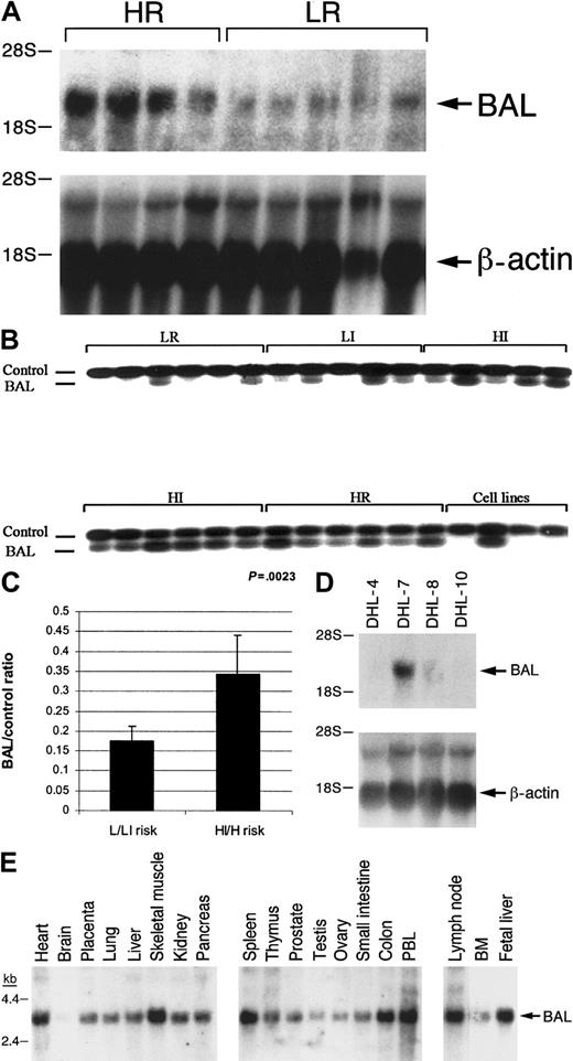 Fig. 1. BAL expression in DLB-CLs (primary tumors and cell lines) and normal human tissues. / (A) Northern blot analysis of primary DLB-CLs from patients with known clinical characteristics, well-defined IPI risk profiles, and mature follow-up whose specimens were analyzed in initial differential display. The filter was hybridized with the differential display product equivalent to the 3′ end of BAL cDNA. The approximately 3.2-kb BAL transcript is more abundant in high risk (HR) than in low risk (LR) primary DLB-CLs. The filters were also hybridized with β-actin to confirm equal loading. (B) Semiquantitative duplex RT-PCR analysis of BAL expression in an additional series of primary DLB-CLs from patients with well-characterized IPI risk profiles, long-term follow-up, and aggressive B-cell lymphoma cell lines (DHL-4, DHL-7, DHL-8, and DHL-10). (C) Densitometric analysis ofBAL expression in the expanded series of primary DLB-CLs (shown in B). The abundance of BAL in a given sample was determined by comparing the intensity of coamplified BAL and internal control signals via scanning densitometry. Thereafter, a ratio of the intensity of the 2 bands was generated to reflect BAL expression. Densitometric profiles of BAL expression in tumors from patients with low/low-intermediate–risk and high-intermediate/high–risk (IPI) disease are shown and demonstrated to be significantly different (P = .0023, 1-sided Student t test). (D) Northern blot analysis of BAL transcripts in the aggressive B-cell lymphoma cell lines (DHL-4, DHL-7, DHL-8, and DHL-10). The filters were also hybridized with β-actin to confirm equal loading. (E) Northern blot analysis of BAL transcripts in multiple normal human tissues.
