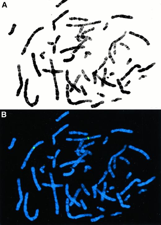 Fig. 3. BAL chromosomal localization. / FISH analysis of a normal human metaphase with genomic PAC clones encompassing the BALlocus. (A) Giemsa-banded metaphase. (B) FISH in which the green signals indicate BAL-PAC clones hybridized to chromosome band 3q21.