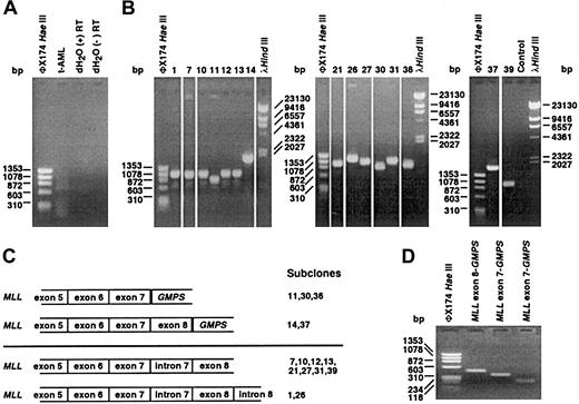 Fig. 1. Analysis of t-AML by cDNA panhandle PCR. / (A) cDNA panhandle PCR analysis of total RNA from peripheral blood mononuclear cells at t-AML diagnosis. As shown by the smear in the second lane of gel (t-AML), a population of products of various sizes was obtained from reverse transcribing first-strand cDNAs with 5′-MLL-random hexamer-3′ oligonucleotides, generating second-strands by MLL primer extension and forming stem-loop templates and 2 sequential PCRs with primers, all fromMLL.9 dH2O control reactions with and without reverse transcriptase (RT) are in lanes 3 and 4. (B) Recombination PCR-generated subclones were screened with the sameMLL primers used in nested PCR.9 The 15 subclones contained inserts that ranged in size from 727 bp to 1653 bp. Subclone numbers above the lanes correspond with the sequences in panel C. Control lane is reagent control. (C) Three subclones contained an in-frame fusion of MLL exon 7 to GMPS at position 150 of the 2212-bp full-length cDNA (GenBank accession no. NM_003875)(top). Two subclones contained a fusion of MLLexon 8 to the same position of GMPS (top). Ten subclones suggested incompletely processed MLL-containing transcripts (bottom). (D) MLL exon 6/GMPS gene-specific primer set yielded 472-bp and 358-bp products, confirming transcripts fusing MLL exon 8 or MLL exon 7, respectively, toGMPS. Lane 2 shows purified product with MLL exon 8-GMPS fusion. Lane 3 shows purified product withMLL exon 7-GMPS fusion. Lane 4 shows a 223-bp product obtained with MLL exon 7/GMPSgene-specific primer set that confirmed MLL exon 7-GMPS fusion.