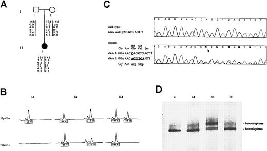 Fig. 1. Pedigree, mutation detection, and X chromosome inactivation analysis. / (A) Pedigree of the family and results of the polymorphism analysis with 6 F8 markers. From the top to the bottom: CA repeat ofF8 intron 13, F8 BclI intron 18, CA repeat ofF8 intron 22, XbaI/KpnI F8 intron 22, DXS 52, and DXS 15 mapping 3 recombination units from the F8 gene. (B) X-inactivation analysis at the HUMARA locus. On the top line, results of the PCR amplification of the androgen-receptor polymorphic (CAG) repeat without HpaII digestion. The proband (II.1) is heterozygous at this locus and inherited the allele 186 from her mother and the allele 198 from her father. Her paternally derived allele (198) is completely digested by the methylation-sensitive restriction enzymeHpaII and, therefore, not amplified by PCR. The remaining peak (186) is the maternally derived allele and represents the inactive, methylated X chromosome that resists cleavage byHpaII and thus is successfully amplified. This female patient thus shows complete skewing of X inactivation. (C) Identification of the Q565delC/ter566 mutation in theF8 gene. F8 exon 11 direct nucleotide sequence fragments are shown in an unrelated wild-type control and in the patient with the relevant wild-type and mutant sequences noted to the left. In the mutated allele, a C is deleted (arrow) and results in overriding of the wild-type and mutated sequences 3′ to the deletion point. (D) Exon 11 mutation DGGE screening in the family. Lane 1, migration pattern of the wild-type alleles from a control subject (C). Lane 2 and 4, DNA samples from the proband's mother (I.2) and the proband's father (I.1), respectively, demonstrating a same migration pattern than the control. Lane 3, DGGE profile of the Q565delC/ter566 mutation from the heterozygous female patient (II.1).