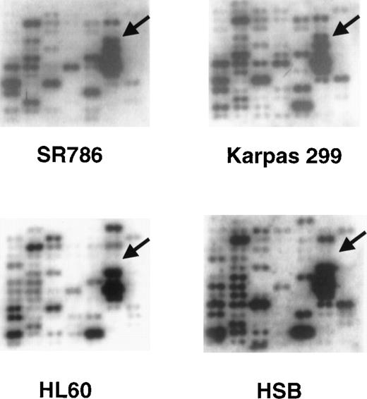 Fig. 1. Representative Clontech human Atlas macroarray analyses. / The cDNA hybridization patterns from 2 ALCL cell lines (SR786 and Karpas 299) and 2 non-ALCL cell lines (HL-60 and HSB) from 1 field of the Atlas array are shown. The arrows identify the position of theclusterin gene cDNA and show strong hybridization signals in the 2 ALCL cell lines and no signals in the non-ALCL cell lines.