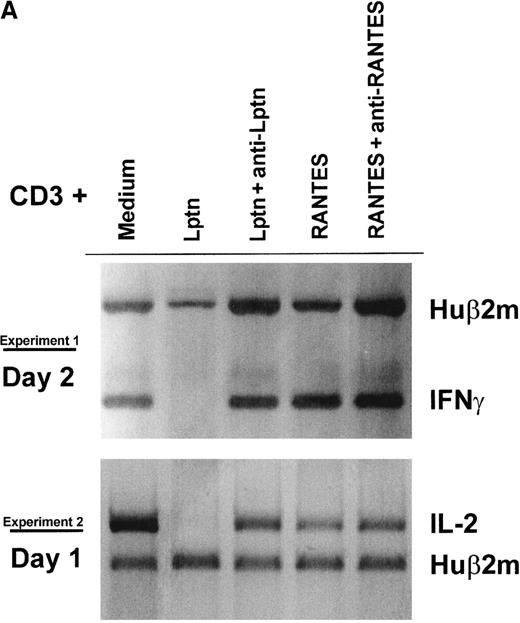 Fig. 4. Lptn impairs the induction of Th1 but not Th2 type genes. / (A) CD4+ T cells were collected after activation for 24 or 48 hours, followed by RNA extraction, reverse transcription, and PCR using primer pairs specific for both Huβ2m and IL-2 at 24 hours, and for both Huβ2m and IFN-γ or IL-13 (not shown for IL-13) at 48 hours, as described in “Materials and methods.” One experiment of 4 is shown for either IL-2 or INF-γ. (B) Quantification of the RT-PCR experiments shown in panel A. Integrated intensity of the respective bands was determined as described in “Materials and methods.” Data shown represent the mean value ± SD (error bar) of the lymphokine/Huβ2m signal ratio, calculated from 4 different experiments. The expression of IL-13 mRNA gave similar intensities with or without Lptn (not shown). (C) JA16 cells were electroporated with pIL-2, pIFN-γ, or pIL-4-Fluc constructs, together with pβ-actin-Rluc, as described in “Materials and methods.” After transfection, cells were either left unstimulated (not shown) or stimulated overnight as indicated. For each lymphokine promoter construct and each activation condition, the relative luciferase activity (RLU) corresponds to the ratio of Fluc expression to that of Rluc, and each RLU value is representative of at least 3 independent experiments. RLU obtained for PMA+ionomycin were 123.2 (2.44), 1.77 (0.024), 1.07 (0.81) for pIL-2, pIFN-γ, pIL-4, respectively, with SD in parentheses. Whatever the promoter used, RLU of unstimulated cells was 5- to 15-fold lower than in CD3-stimulated cells (not shown).