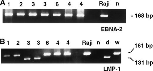 Fig. 8. PCR for LMP gene. / (A) Strain typing for EBV using EBNA-2 primers demonstrates strain type A in all cases. (B) PCR analysis of the LMP-1 gene shows wild-type gene product (WT, 161 bp) in cases 1, 2, 6, 4. A deleted LMP-1 gene product (del, 131 bp) is noted in case 3; n indicates negative control).
