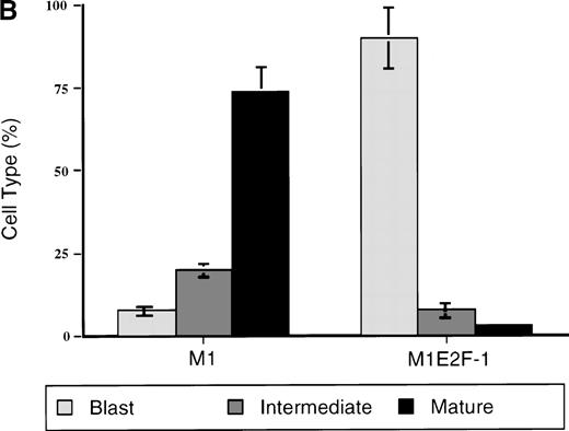 Fig. 3. Analysis of the morphologic characteristics of M1 and M1E2F-1 cells before and after treatment with IL-6. / (A) Representative photomicrographs of May-Grünwald-Giemsa–stained cytospin smears of cells are shown (magnification, ×400). Cells were seeded at 0.1 × 106/mL and treated with IL-6 (50 ng/mL) for 3 days before they were collected for analysis. (B) Cell-type distribution of M1 and M1E2F-1 cells at 3 days after IL-6 stimulation. Morphologic differentiation was determined by counting at least 300 cells on stained cytospin smears, and scoring the proportion of immature blast cells, cells at intermediate stages of differentiation, and mature macrophages. For each cell type, analysis was performed several times with similar results. The data represent a mean value obtained from at least 3 independent determinations and have a standard deviation of ± 15%. Furthermore, there was no difference in the response of the parental M1 cells and the control M1-puromycin cells transfected with the empty puromycin vector.