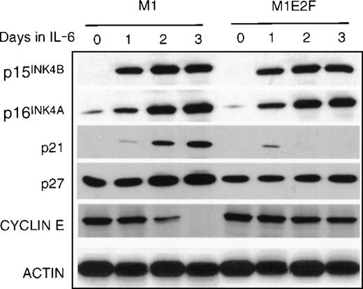 Fig. 5. Protein expression in M1 and M1E2F-1 cells. / Protein extraction and immunoblotting were as described in “Materials and methods,” and Figure 1.