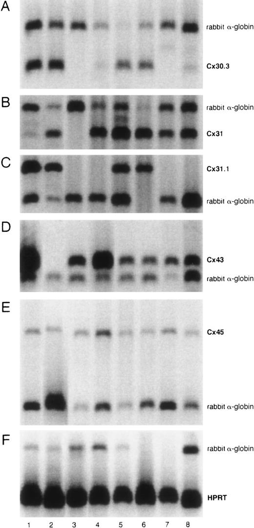 Fig. 1. Semiquantitative Cx mRNA expression in stromal cell lines. / The experiment shows the expression of Cx30.3 (182 bp, A), Cx31 (182 bp, B), Cx31.1 (357 bp, C), Cx43 (294 bp, D), and Cx45 (444 bp, E) in 8 different stromal cell lines. Rabbit α-globin was used as an internal standard (257 bp). HPRT was used as a housekeeping control gene (179 bp, F). Analyses were performed at least twice. Lane 1, FLB6-1; lane 2, FLB6-2; lane 3, FBMD-1; lane 4, NBM11F4G; lane 5, FL1E2C; lane 6, FL7H7B; lane 7, NBM11F10H; and lane 8, NBM6D3D.