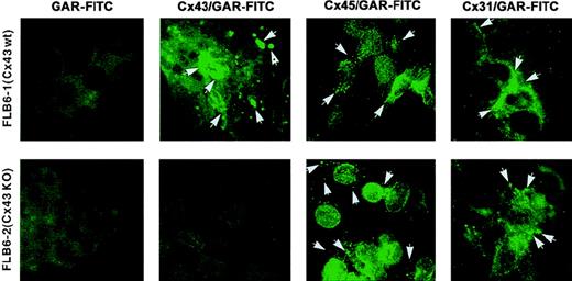 Fig. 2. Cx expression assessed by immunofluorescence. / Cx43, Cx45, and Cx31 expression as assessed by immunofluorescence in Cx43-wt (FLB6-1) and Cx43− (FLB6-2, from Cx43-KO mice) FL cells (OM: × 630). Note that fluorescence (arrows) is distributed in a punctate way or in thick fluorescent spots at the plasma membrane, frequently at the most distal points. Variable expression is also observed at the perinuclear area. Note that Cx43 and Cx31 expression form thicker fluorescent spots than Cx45 meanwhile. GAR-FITC, goat antirabbit FITC conjugate. See “Results” for additional description.