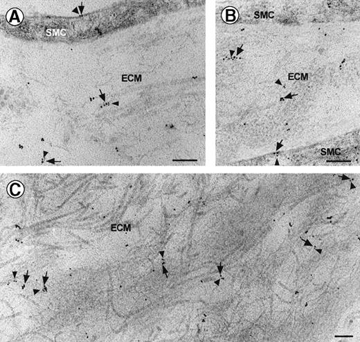 Fig. 7. Localization of vitronectin and kininogen in human advanced atherosclerotic lesions by double-labeling immunogold electron microscopy. / Vitronectin (10 nm gold particles, arrowheads) is detected both bound to plasma membranes of smooth muscle cells (SMC) (A and B) as well as in association with different fibrillar or amorphous extracellular matrix structures (ECM) (A, B, and C). Kininogen, labeled by 15 nm gold particles (arrows), was found in similar locations. Frequently, the 2 proteins were localized in close proximity, occasionally in direct apposition, indicating close molecular interaction (arrows and arrowheads); bars = 0.5 μm.