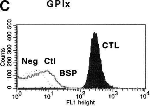 Fig. 1. Flow cytometric analysis of platelets from a patient with Bernard-Soulier syndrome (BSS). / Analysis was performed on whole blood with monoclonal antibodies (mAbs) against glycoprotein (GP) IIb-IIIa (A), GPIbα (B), GPIX (C), and GPV (D). As expected BSS patients' platelets (BSP), which are larger than normal, this patient's platelets (clear area) showed an increase in surface fluorescence compared with platelets from healthy controls (CTL, shaded area) in reaction to the anti-GPIIb-IIIa mAb LYP18. There was no detectable GPIbα (B) or GPIX (C) on the platelets of the patient (clear area), whereas both were present on control platelets (shaded area).