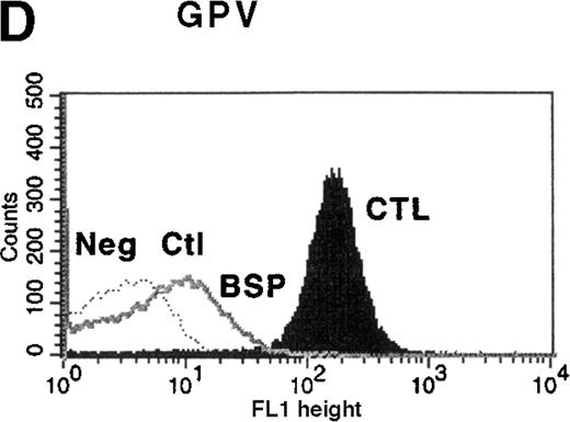 Fig. 1. Flow cytometric analysis of platelets from a patient with Bernard-Soulier syndrome (BSS). / Analysis was performed on whole blood with monoclonal antibodies (mAbs) against glycoprotein (GP) IIb-IIIa (A), GPIbα (B), GPIX (C), and GPV (D). As expected BSS patients' platelets (BSP), which are larger than normal, this patient's platelets (clear area) showed an increase in surface fluorescence compared with platelets from healthy controls (CTL, shaded area) in reaction to the anti-GPIIb-IIIa mAb LYP18. There was no detectable GPIbα (B) or GPIX (C) on the platelets of the patient (clear area), whereas both were present on control platelets (shaded area).