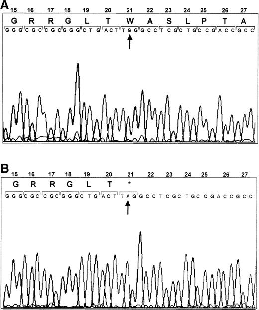 Fig. 2. Mutation in GPIbβ. / DNA-sequence analysis of GPIbβ from a healthy volunteer (A) and the patient with BSS (B). Sequence analysis of DNA amplified by polymerase chain reaction showed that nucleotide 159, part of a TGG codon, was replaced by an A, yielding a TAG stop signal.