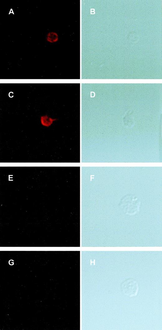 Fig. 4. GPIbα-IX complex formation in BSS platelets. / Washed platelets from healthy volunteers (A-D) and the patient with BSS (E-H) were plated onto glass slides precoated with fibrinogen (20 μg/mL) and allowed to adhere for 1 hour at room temperature. Platelets were then either permeabilized with ice-cold methanol and acetone before staining (A, B and E, F) or stained directly without permeabilizing (C, D and G, H). Slides were stained for GPIbα-IX with the mAb AK1. Platelets were imaged in parallel in fluorescent (A, C, E, and G) and differential-interference contrast (DIC) mode (B, D, F, and H). The platelets were permeabilized to allow antibody probes to react with cytoplasmic epitopes. Data are presented as paired images separated to show AK1 staining with an Alexa 546–conjugated antimouse antibody or DIC images to indicate the platelet position in the nonstaining cells. One image is shown for each treatment; this is representative of 3 independent experiments in which more than 20 platelets were analyzed. GPIbα-IX complex was present in the cytoplasm and on the surface of normal platelets (A, C) but absent from BSS platelets (E, G). The DIC images show the larger size of the BSS platelets.