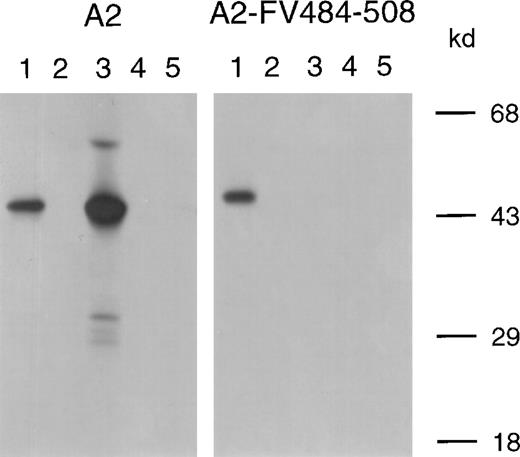 Fig. 4. Immunoprecipitation of variant A2 domain fragments by isolated scFv. / Binding of scFv to recombinant A2 domain and A2-FV484-508 was assessed by immunoprecipitation. Lane 1, positive control (mAb CLB–CAg 9); lane 2, negative control (normal plasma); lane 3, scFv VK34; lane 4, scFv VK41; lane 5, scFv EL-14, directed toward the C2 domain of factor VIII. Molecular weight markers (in kd) are indicated at the right.