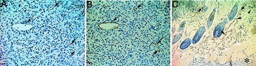 Fig. 5. Induction of VEGFR-3 expression during tumor-induced angiogenesis. / Immunostaining for VEGFR-3 (A) and PECAM-1 (B) in adjacent sections of C6 subcutaneous tumors (day 7) in nude mice (×200). Intratumoral VEGFR-3+ (A, arrows) containing blood cells are also positive for PECAM-1 expression (B, arrows). Note that hemorrhages are not conspicuous at this stage. (C) Immunostaining for VEGFR-3 in a section of C6 tumors with surrounding tissues (×100). Note the presence of VEGFR-3+ (black arrows) and VEGFR-3−(white arrows) vessels, both containing hematopoietic cells. Arrowheads indicate VEGFR-3+ vessels that do not contain hematopoietic cells. Asterisk indicates the edge of a tumor.
