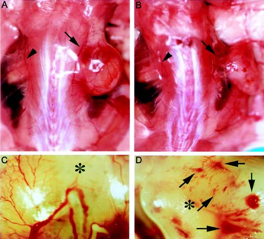 Fig. 6. AFL4 treatment inhibits tumor angiogenesis. / Tumor-bearing regions were photographed on day 14 after tumor transplantation. Gross appearance of representative vascularization of control (A) and AFL4-treated (B) mice. Arrows and arrowheads indicate the vascular trunks governing tumor blood supply and those of the tumor-free side, respectively. Note that the size of the trunk is larger on the tumor-bearing side than on the other side. Such a dilatation is not clearly seen in the AFL4-treated mouse. (C, D) Higher magnification than that in A and B, respectively. Secondary and tertiary branches are poorly developed in the AFL4-treated mouse. Note the many micro-hemorrhages in this AFL4-treated tumor (arrows). Asterisks indicate tumors.