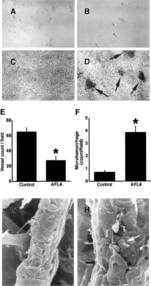 Fig. 7. Histology of intratumor vasculatures. / (A, B) Tumor vasculatures are visualized by anti-PECAM-1 immunostaining. Micrographs are of representative sections prepared from the control (A) and AFL4-treated mice (B) (×200). (C, D) Representative H&E-stained tumor sections from controls (C) and anti-VEGFR-3–treated mice (D) (×200). In anti-VEGFR-3–treated tumors, many micro-hemorrhages are observed (arrows). (E) Vessel counts per field were determined from at least 5 different vision fields of sections from control (n = 4; 65 ± 5.2/high-power field) and AFL4-treated mice (n = 4; 27.5 ± 5.3/high-power field) (×200). Data are plotted as mean ± SEM. *P < .01. (F) The number of micro-hemorrhages was scored in high-power fields (×200) of H&E-stained tumor sections (at least 5 different vision fields each of 4 tumors). Control, 0.73 ± 0.13/high-power field; AFL4, 3.9 ± 0.46/high-power field. Data are plotted as mean ± SEM. *P < .01. Statistical differences between groups were computed using the Student t test. (G) Representative SEM of a postcapillary venule in control tumors (×3800). (H) SEM of a postcapillary venule in anti-VEGFR-3–treated tumors reveals disruption of the endothelial sheet, exposing red blood cells (arrow) (×2200).