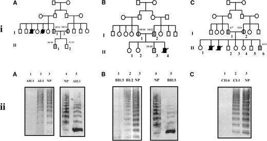 Fig. 1. Pedigrees of and multimer analysis of VWF in plasma from families. / (i) Pedigrees of families A (A), B (B), and C (C). Squares denote males, circles denote females. Slashed symbols represent deceased family members. Inheritance of the intron 40 VNTR-1 is shown as number of ATCT repeat units.3233 (ii) Multimer analysis of VWF in plasma from members of families A, B, and C. Plasma samples were electrophoresed on 2% SDS-agarose gels. In A-C, lanes 1-3 contain equal volumes of plasma (2 μL). In A and B, lanes 4 and 5 contain the appropriate volume of plasma containing 0.5 mU VWF as determined by ELISA. VWF was transferred onto nitrocellulose by electroblotting. In A-C, lanes 1-3 were developed using polyclonal rabbit antihuman VWF antibody and a secondary alkaline phosphatase-conjugated swine antirabbit IgG polyclonal antibody and colorimetric staining. In A and B, lanes 4 and 5 were developed using rabbit antihuman VWF polyclonal antibody and a secondary horseradish peroxidase-conjugated swine antirabbit IgG polyclonal antibody and enhanced chemiluminescence. NP denotes plasma pooled from 20 healthy individuals.